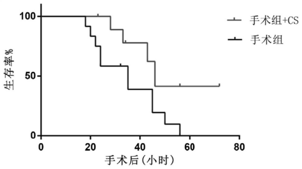 Application of cholesterol sulfate in preparation of medicine for preventing sepsis