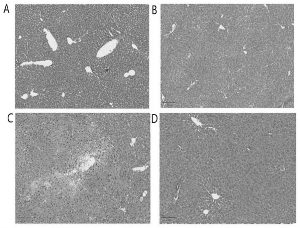 Application of cholesterol sulfate in preparation of medicine for preventing sepsis