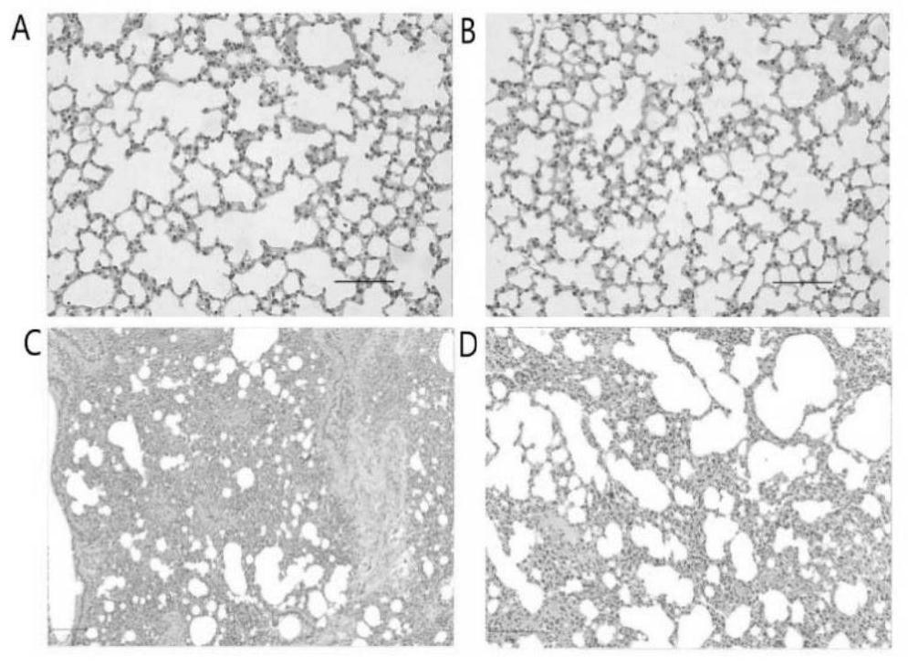 Application of cholesterol sulfate in preparation of medicine for preventing sepsis