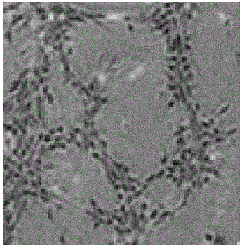 Method for inducing human umbilical cord mesenchymal stem cells to be differentiated into pancreatic beta cells