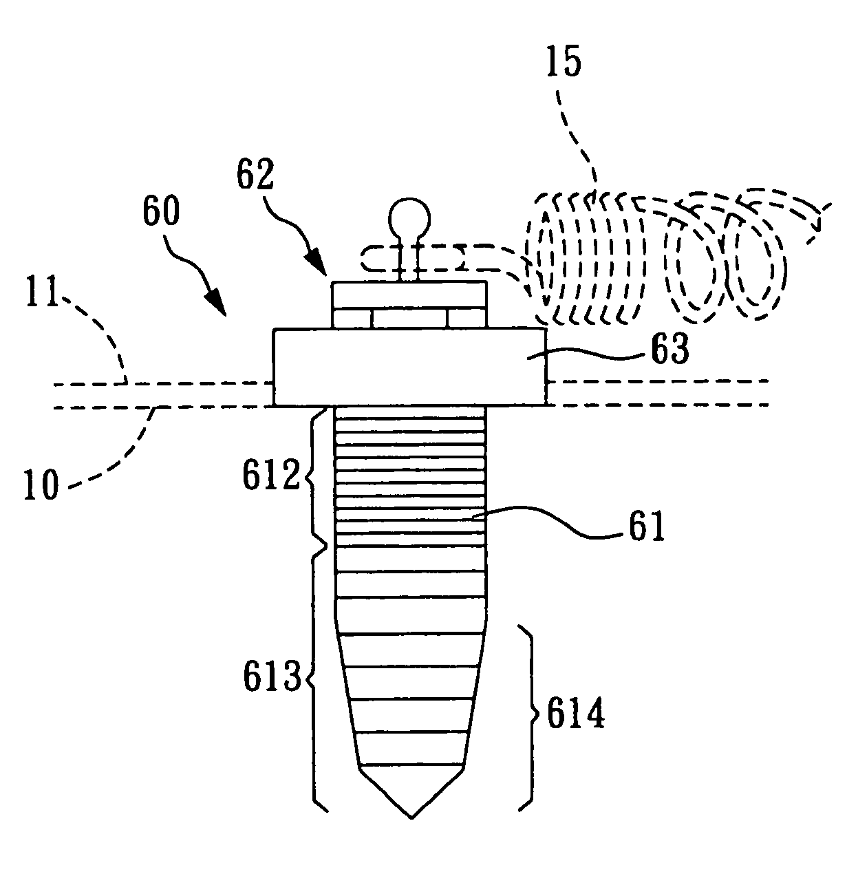 Screw device for orthodontic treatment