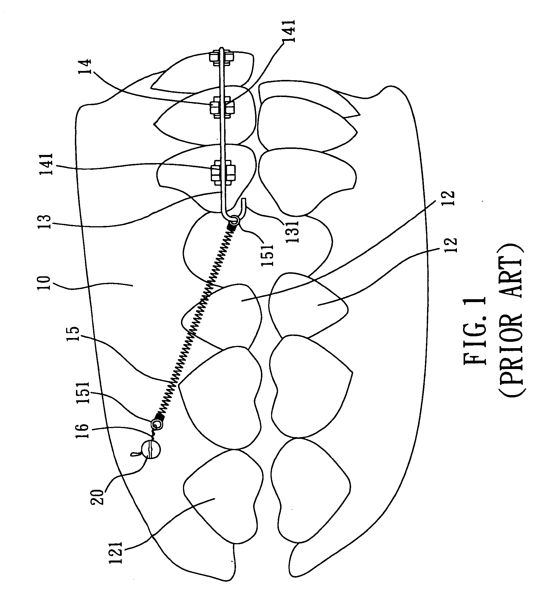 Screw device for orthodontic treatment