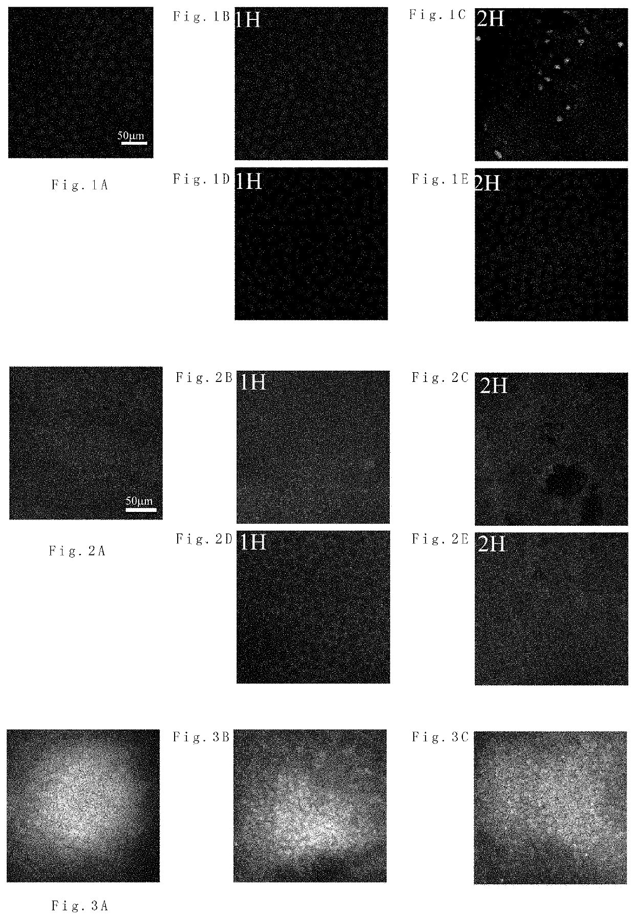 Anterior chamber perfusate for intraocular surgery and method