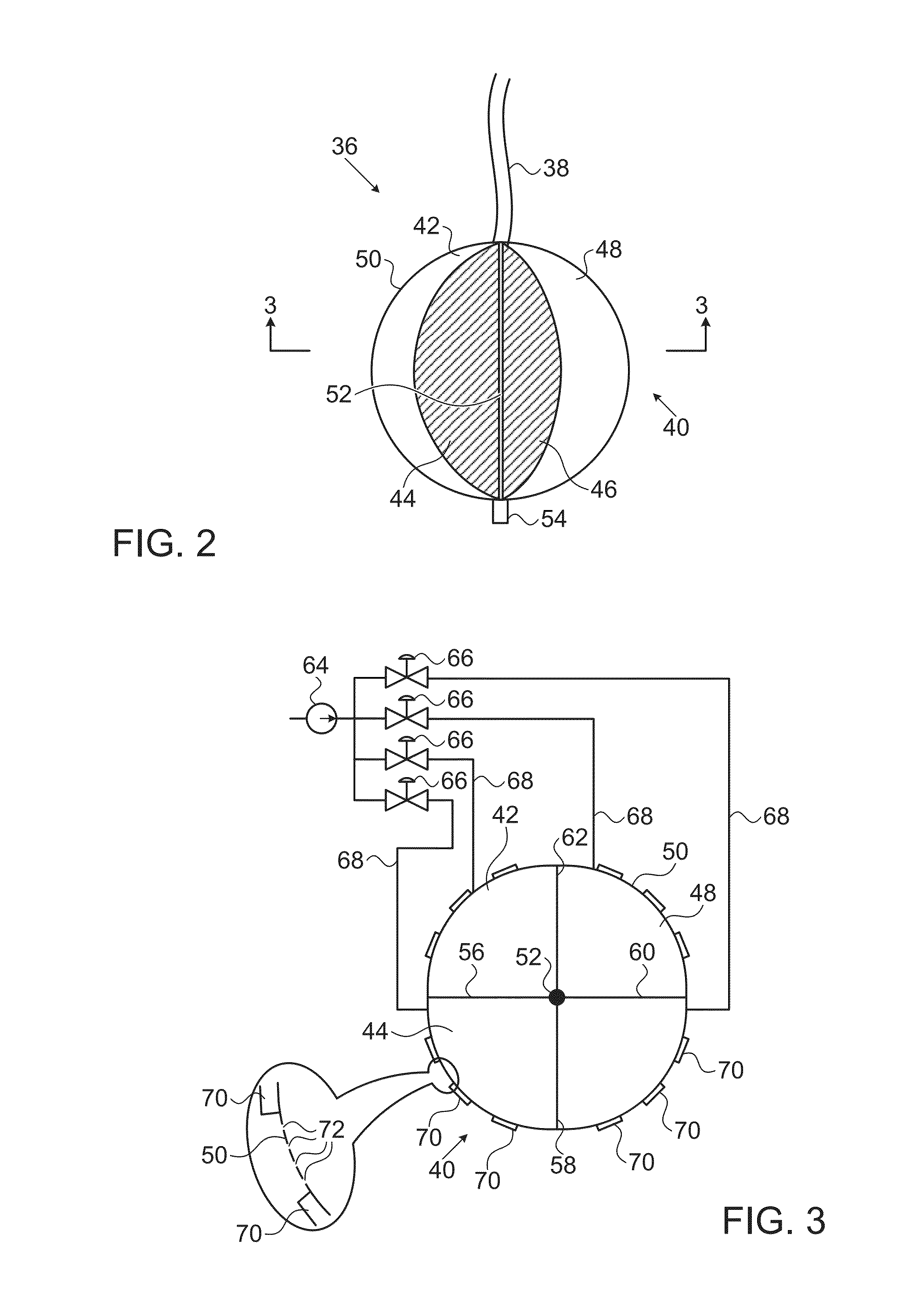 Segmented balloon catheter