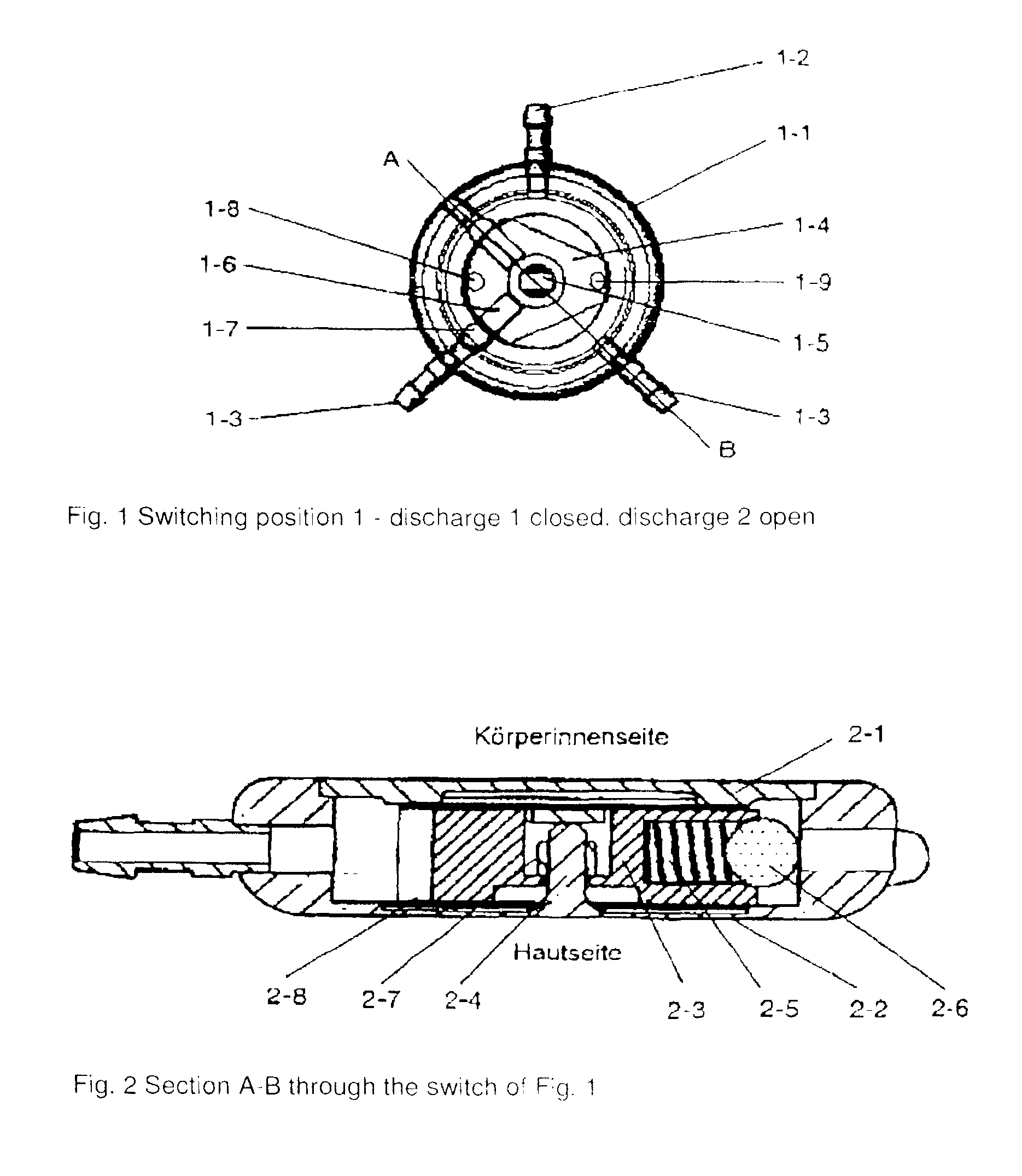 Cerebrospinal fluid drainage