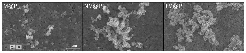 Cell-targeted polypeptide for treating bone tumors as well as preparation method and application of cell-targeted polypeptide