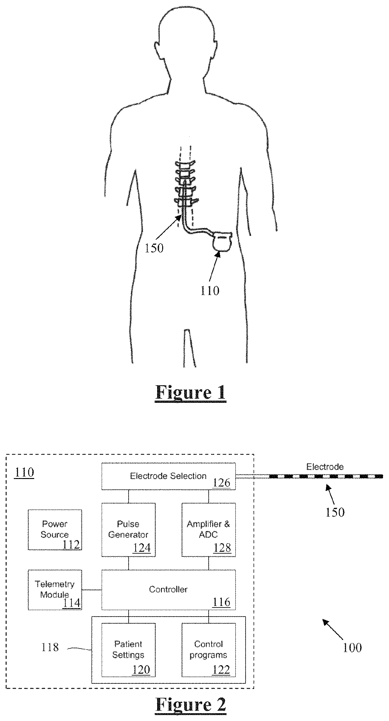 Implantable electrode positioning