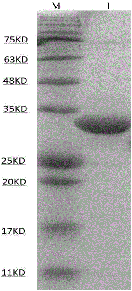 Mycobacterium tuberculosis antigen protein Rv0865 and application of B cell epitope peptide thereof