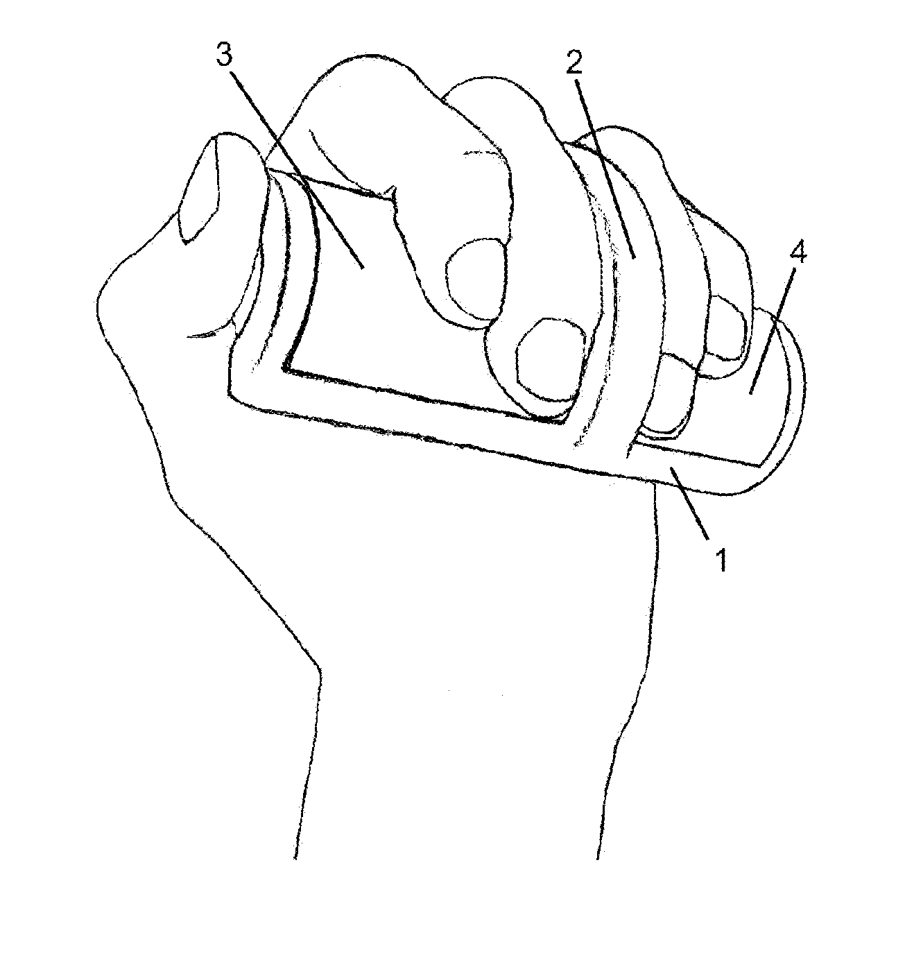 Bioelectrical impedance measuring apparatus