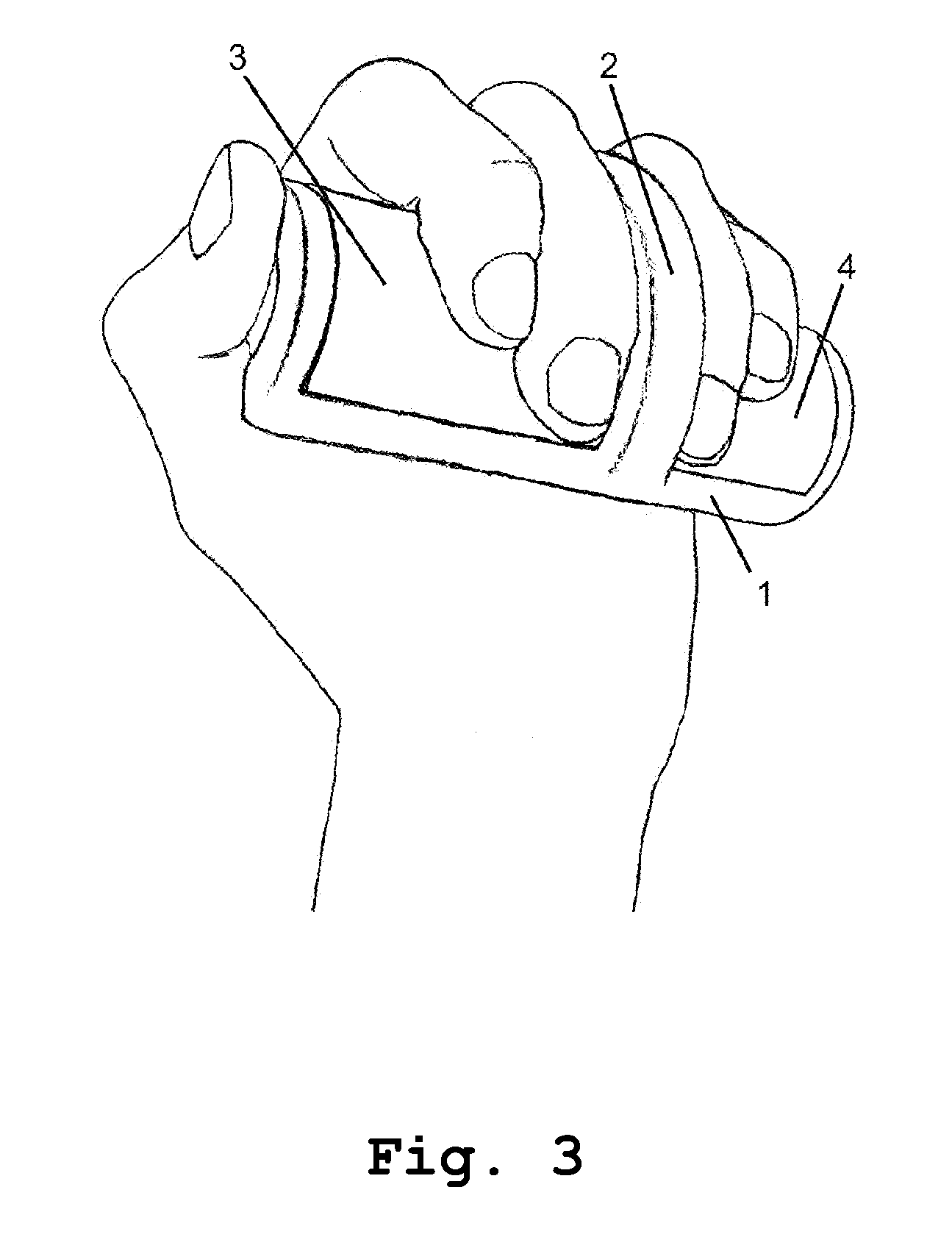 Bioelectrical impedance measuring apparatus