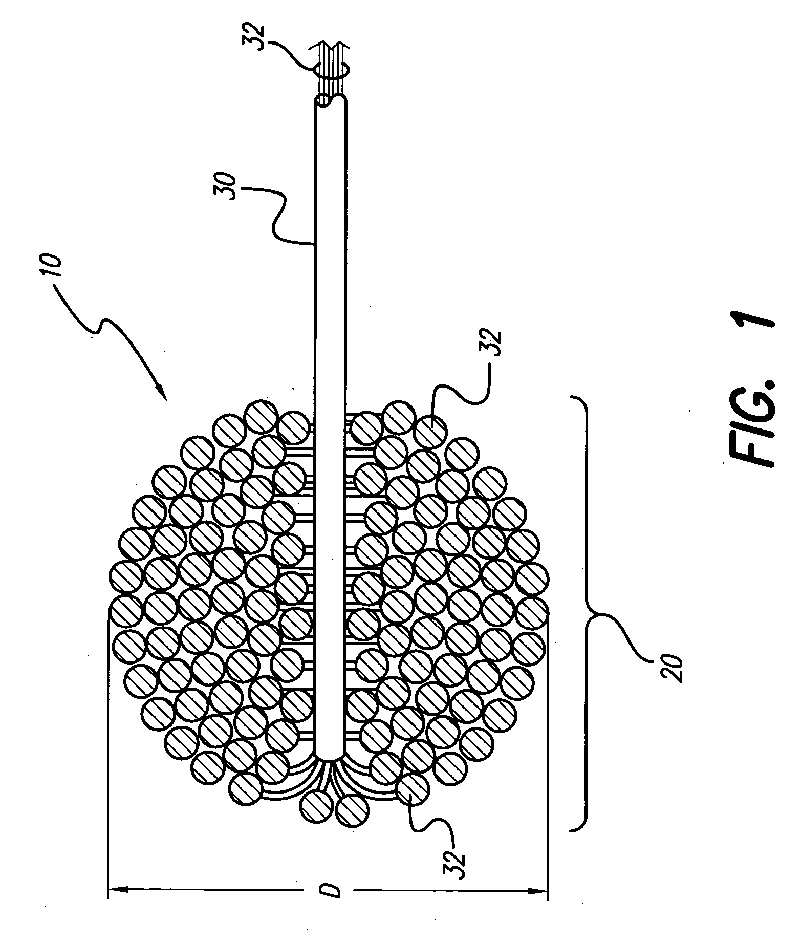 System and method of contra-lateral ear stimulation for preserving neuronal survival and plasticity of the auditory system prior to permanent intra-cochlear implantation