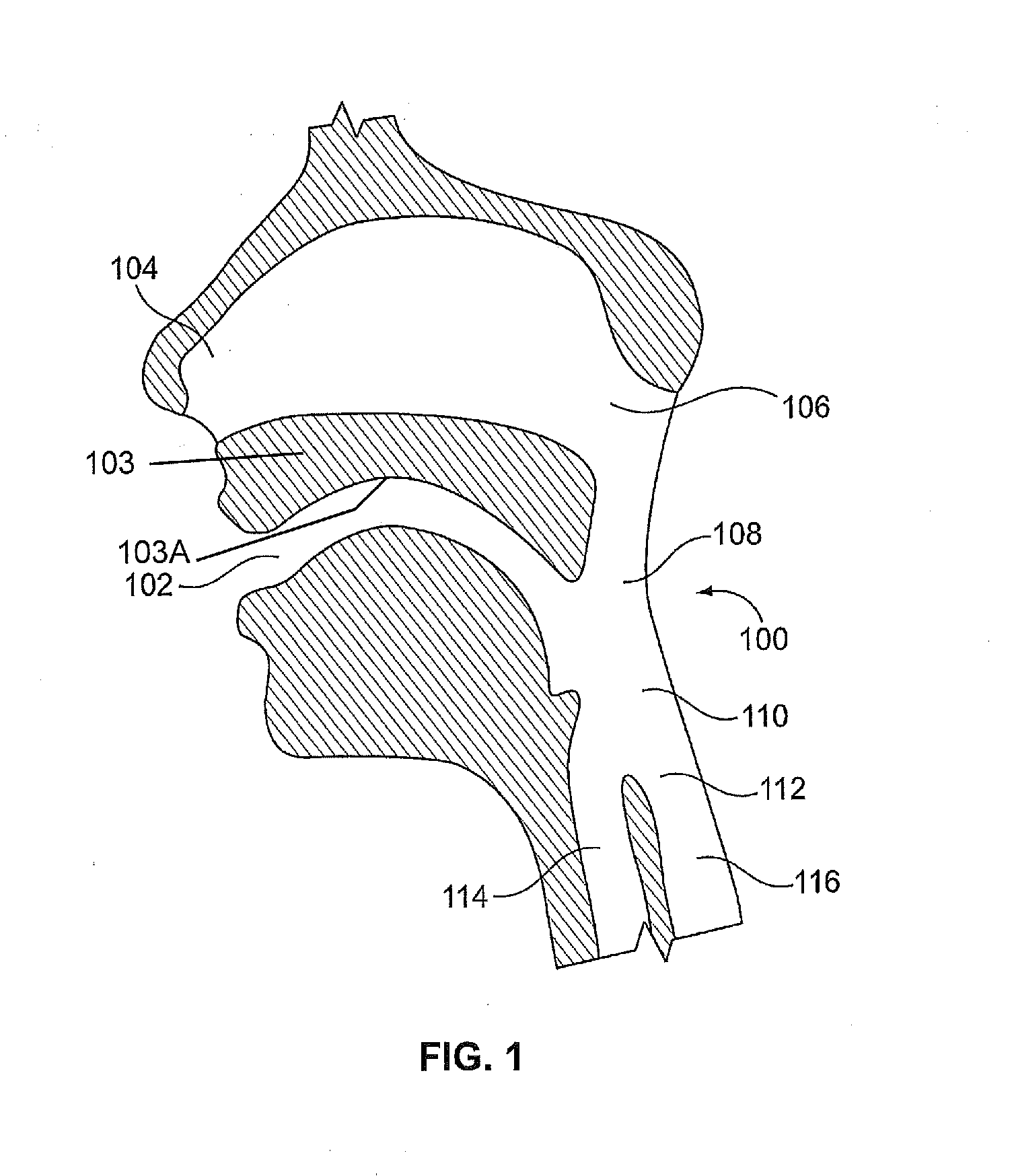 System and methods of intubation