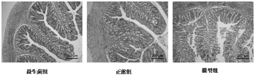 Micro-ecological composition for improving constipation by targeting intestinal flora and preparation of micro-ecological composition