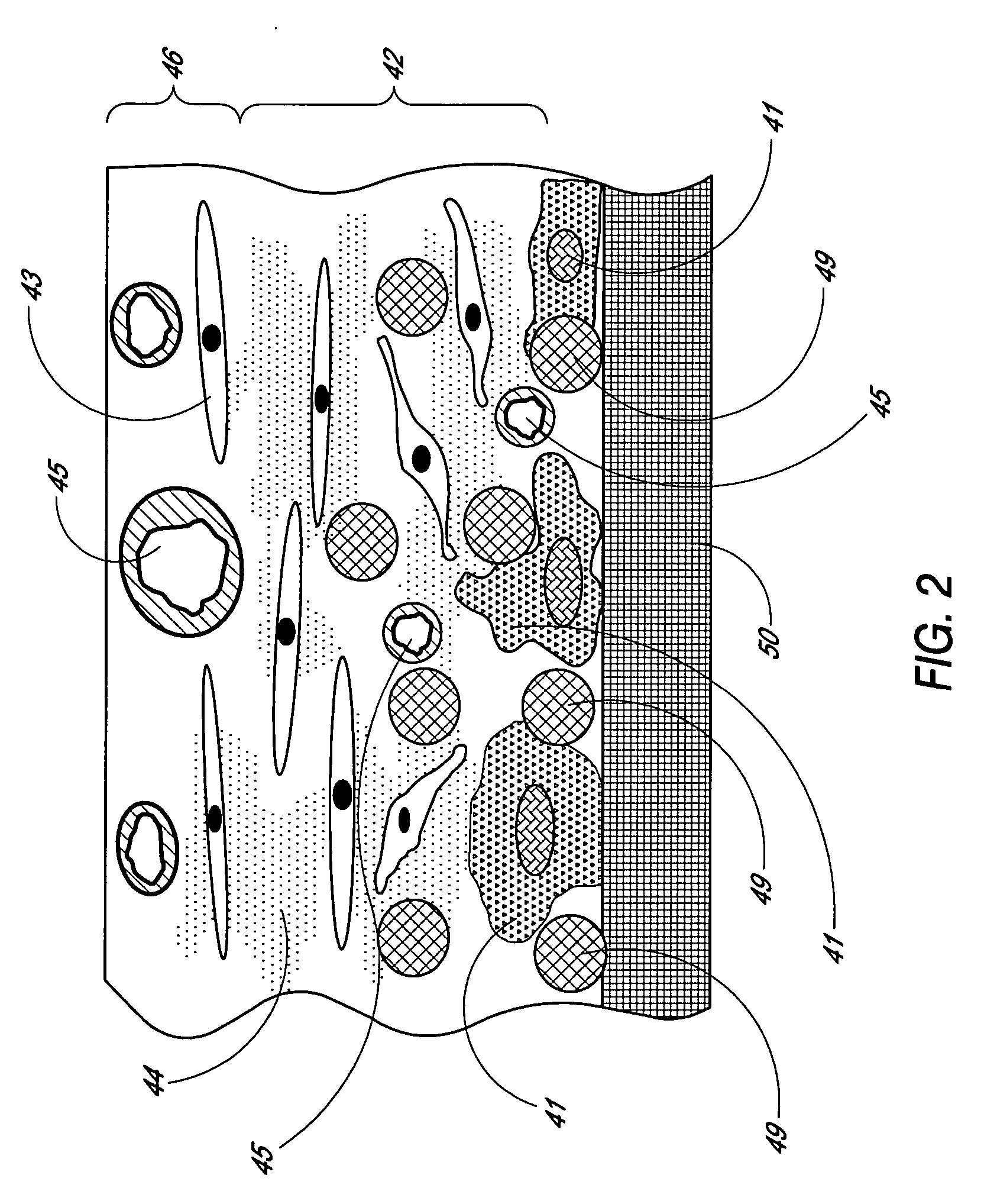 Analyte sensing biointerface