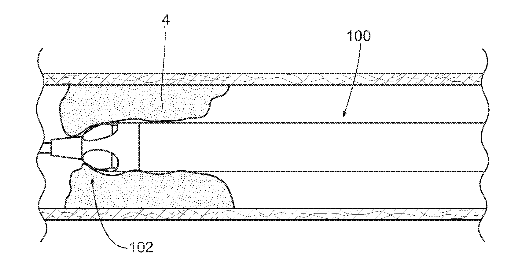 Atherectomy devices and methods