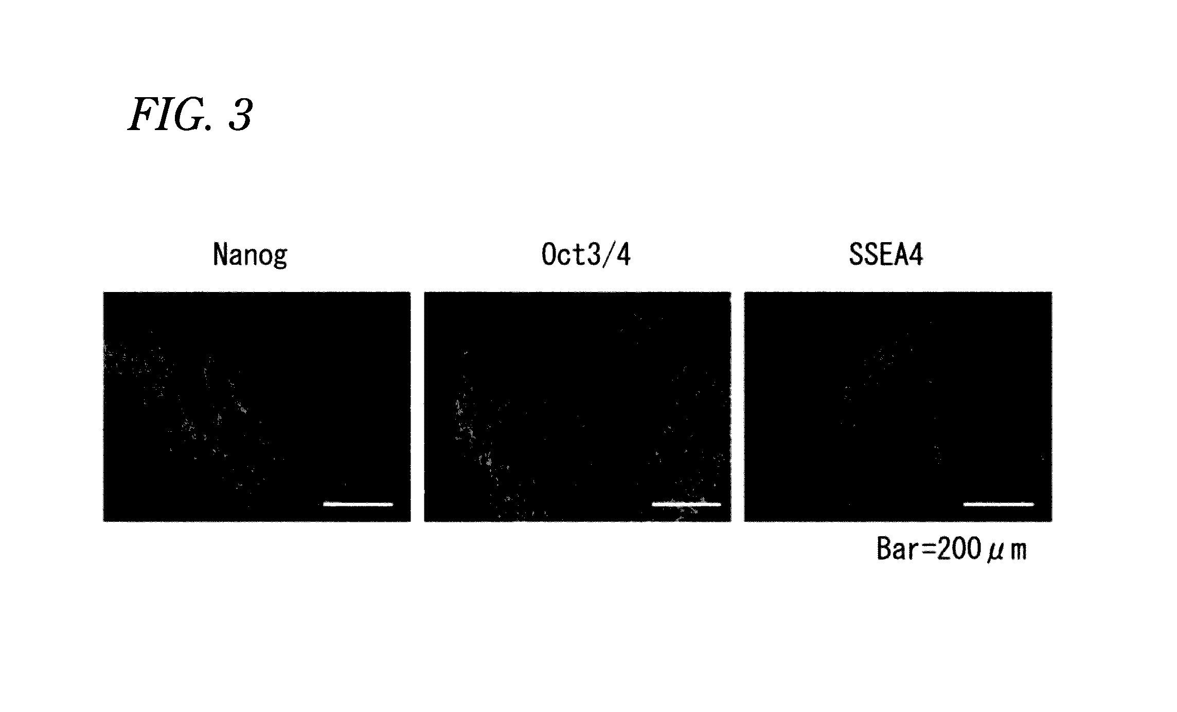 Pluripotent stem cell-derived brown adipocytes, pluripotent stem cell-derived cell aggregate, method for producing same, and cell therapy and medical therapy therefor