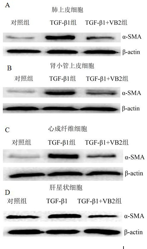 Use of vitamin b2 in the preparation of medicines for preventing and treating fibrotic diseases