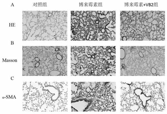 Use of vitamin b2 in the preparation of medicines for preventing and treating fibrotic diseases