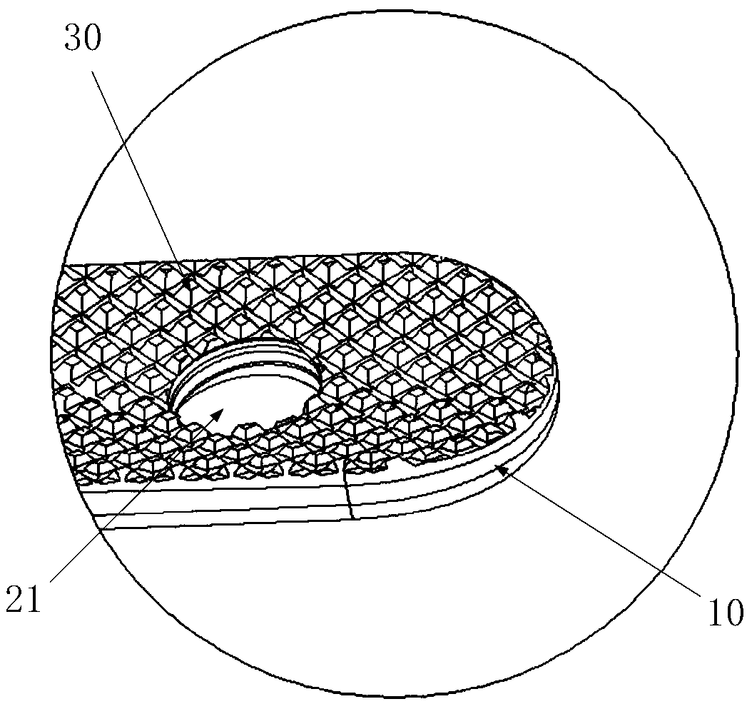 Fusion locking plate and wrist fusion structure