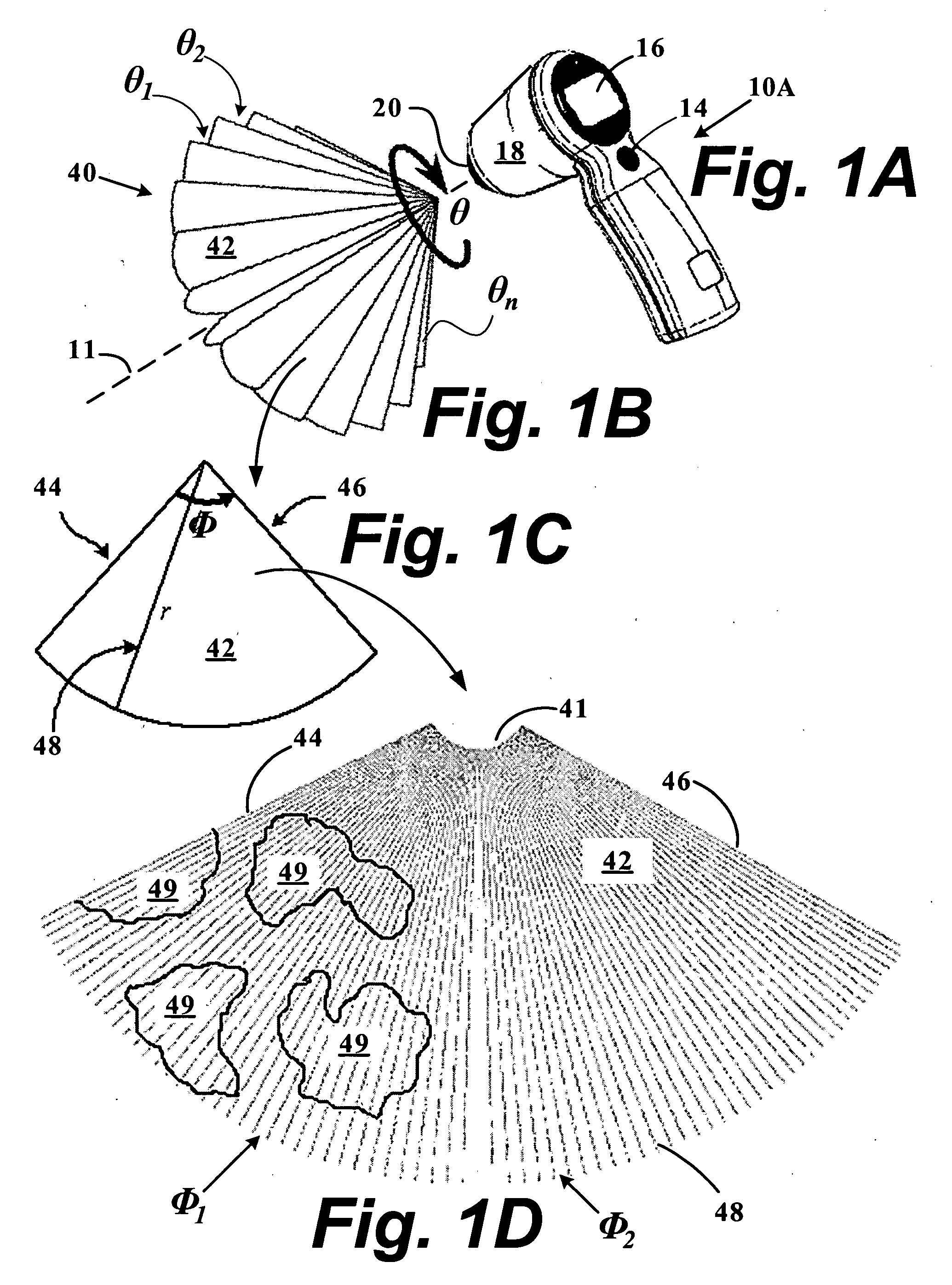 Systems and methods for determining organ wall mass by three-dimensional ultrasound