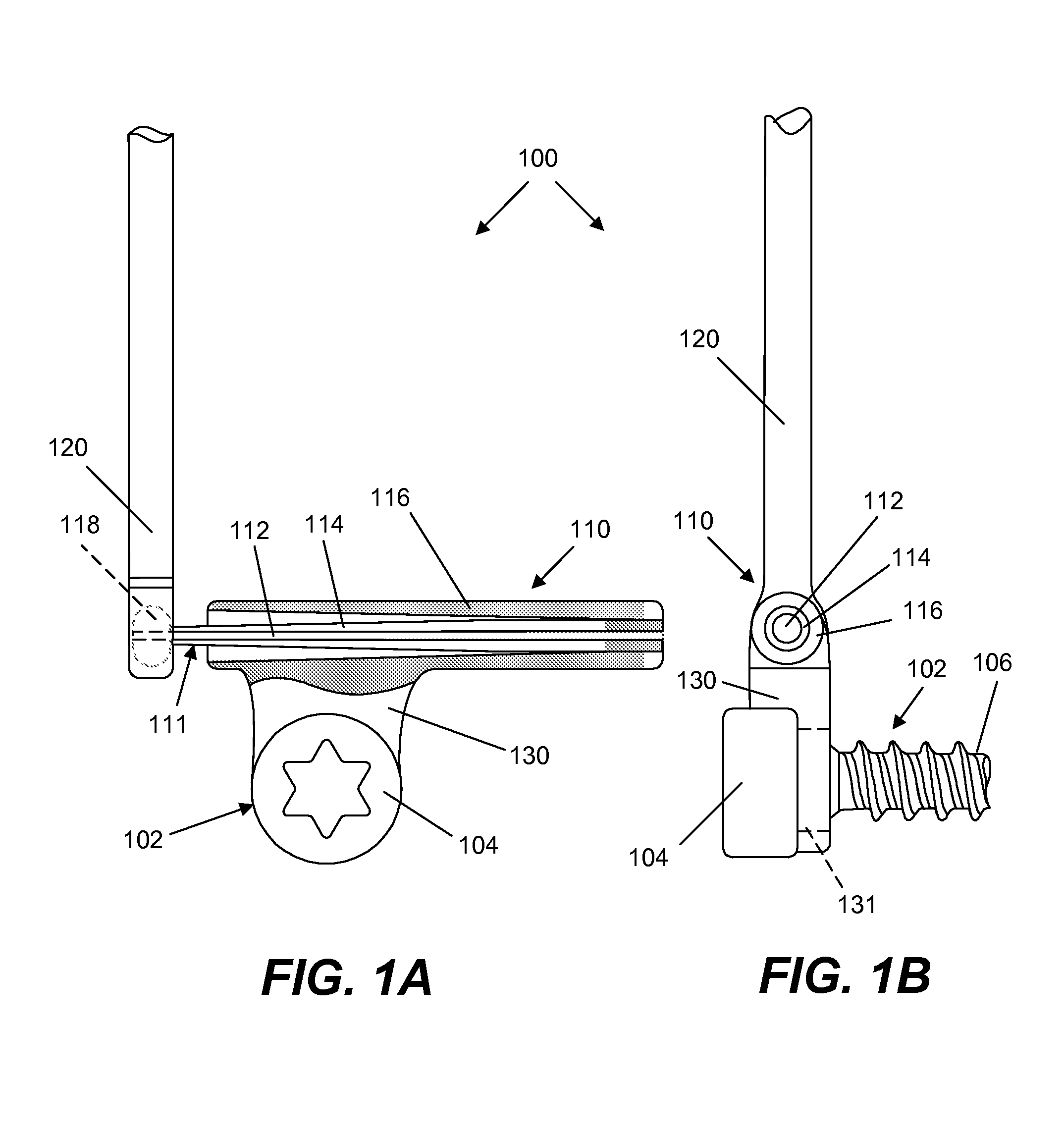 Spine implant with a deflection rod system and connecting linkages and method