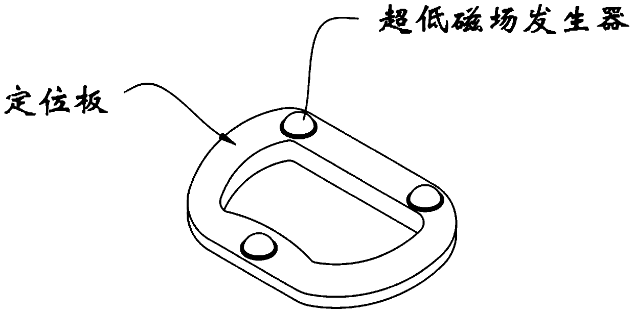 Perimeter mapping method for auricular fibrillation