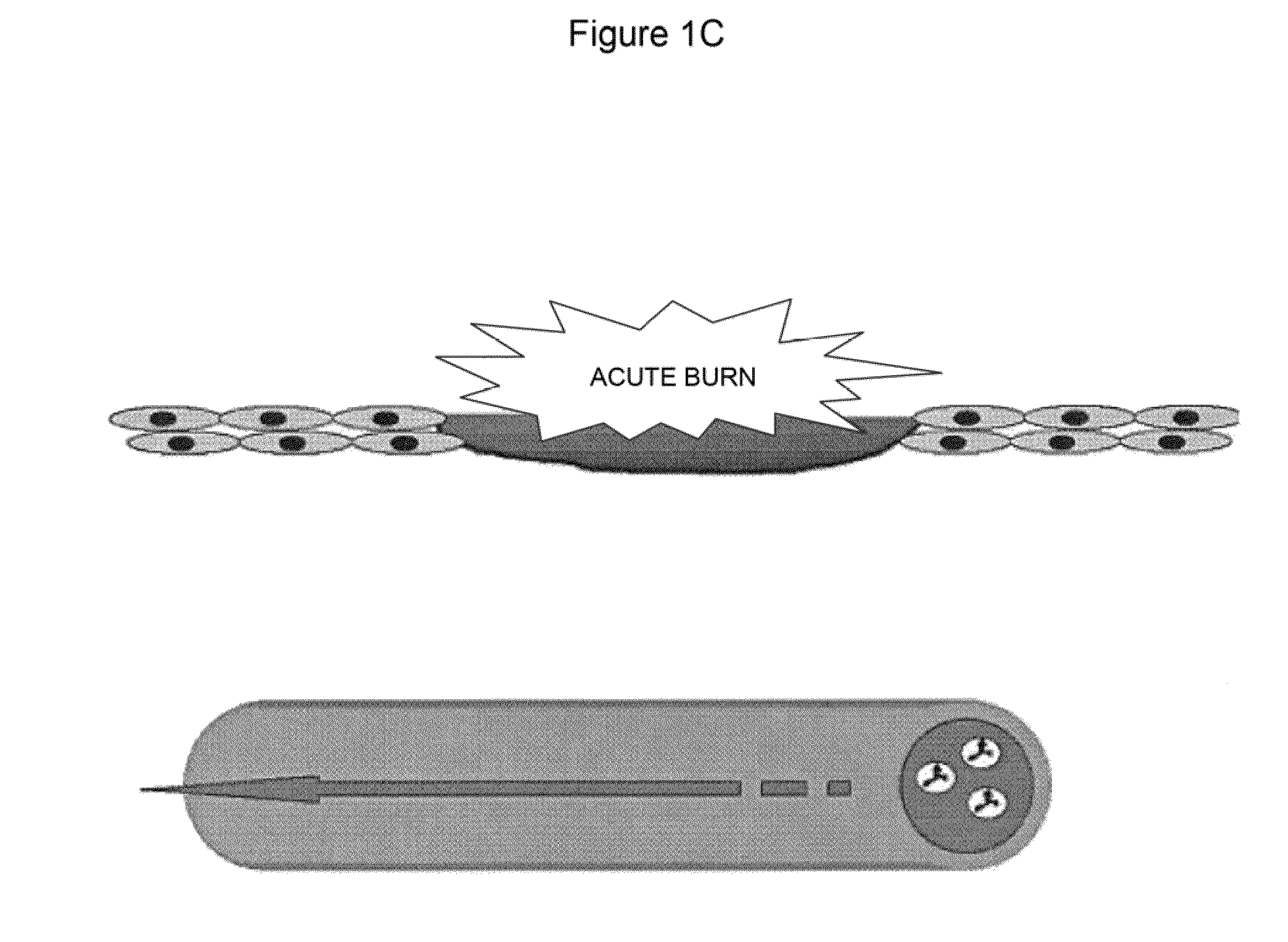 Compositions and Methods for Treating Burns