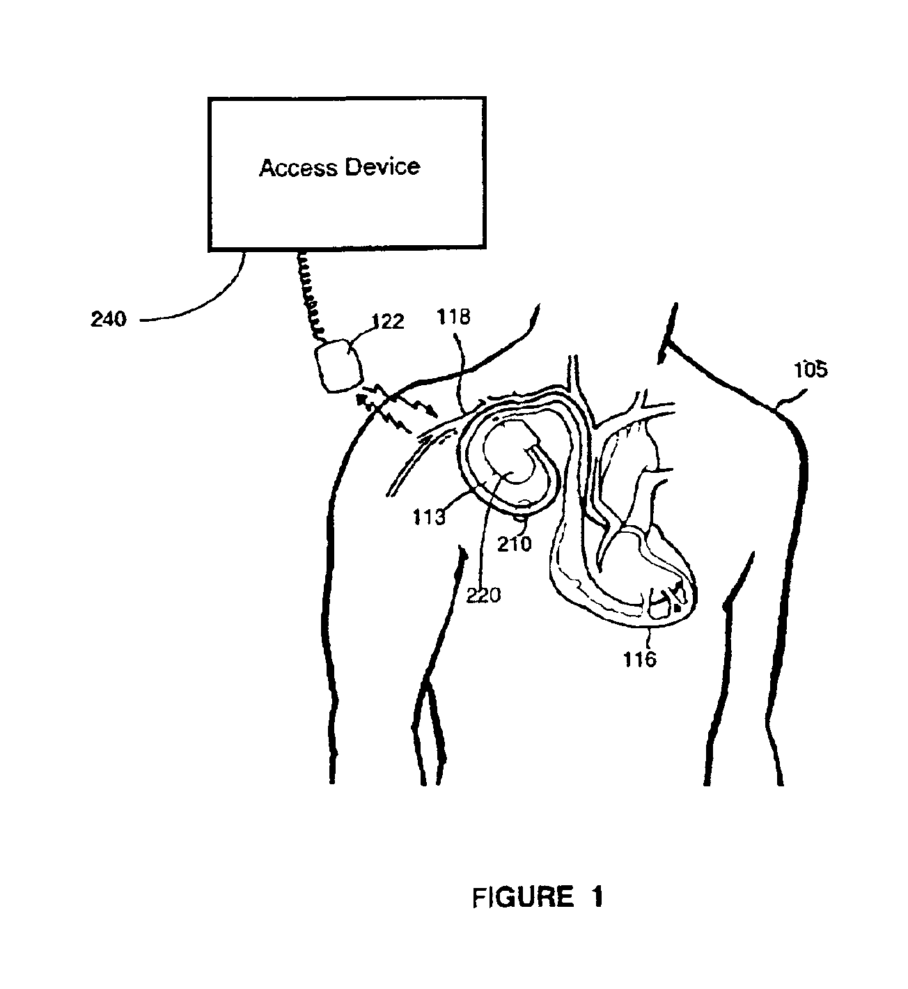 Method and apparatus for synchronization of clock domains