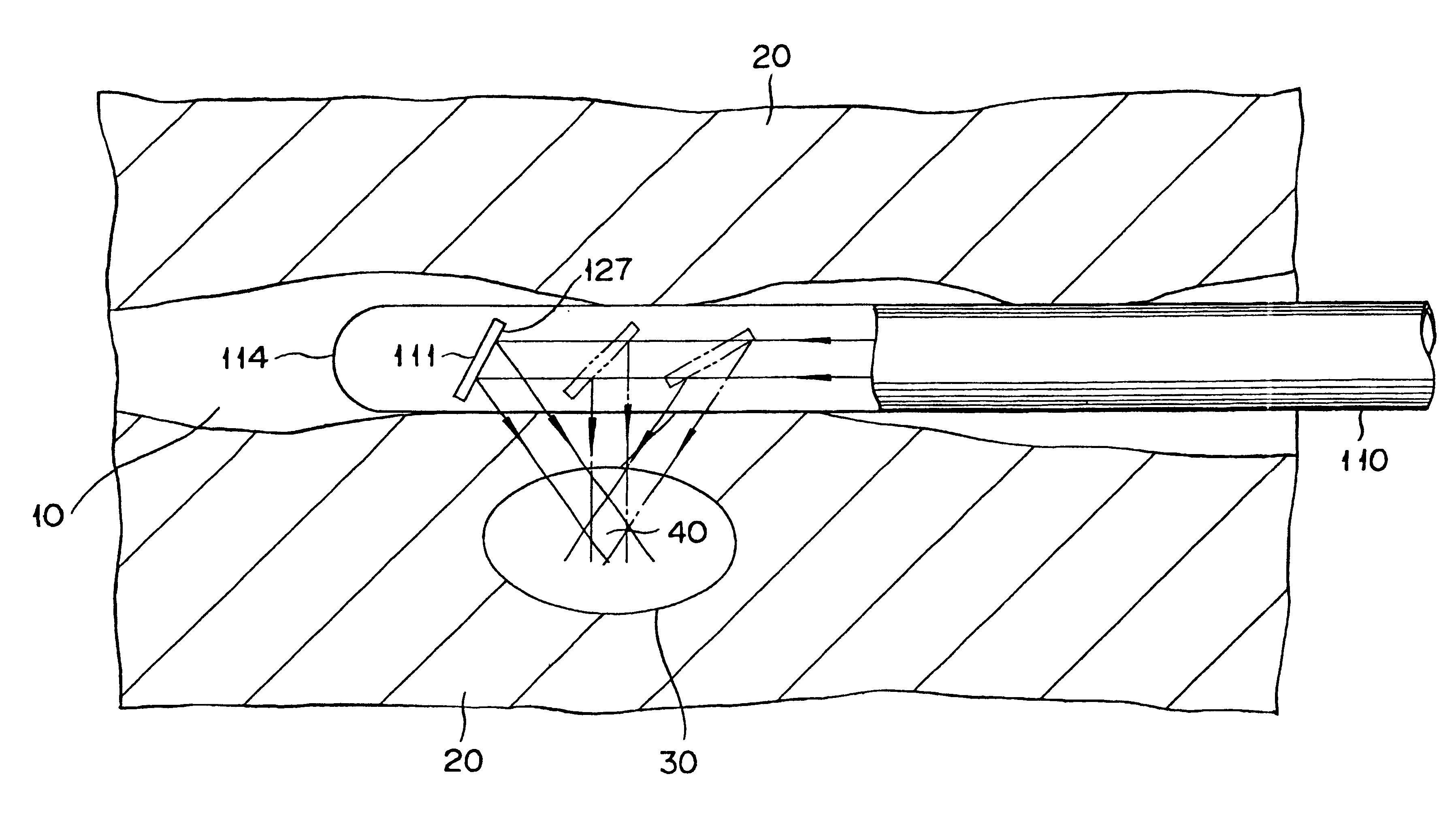 Energy irradiation apparatus