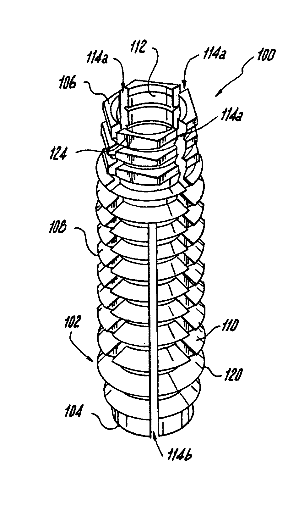 Orthopedic screw insert