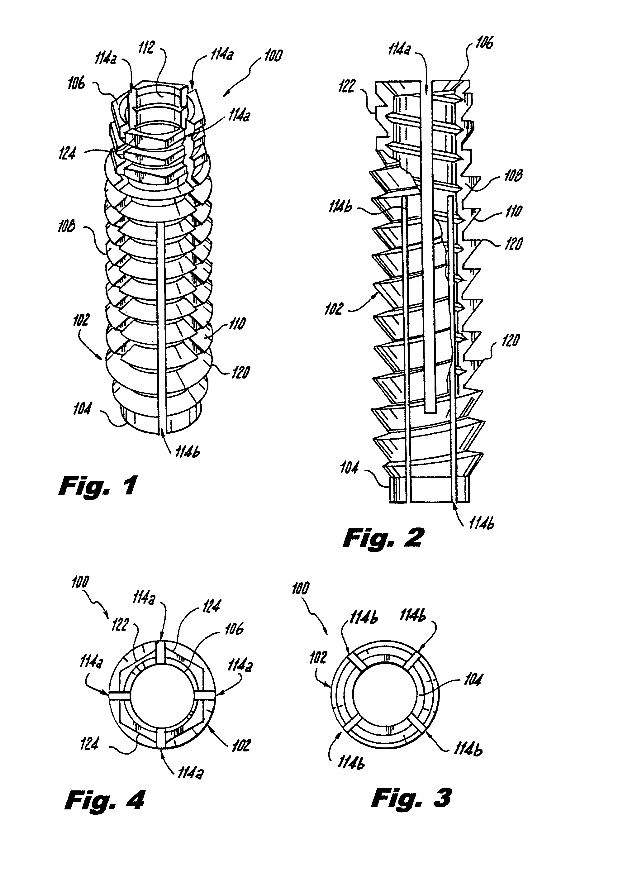 Orthopedic screw insert