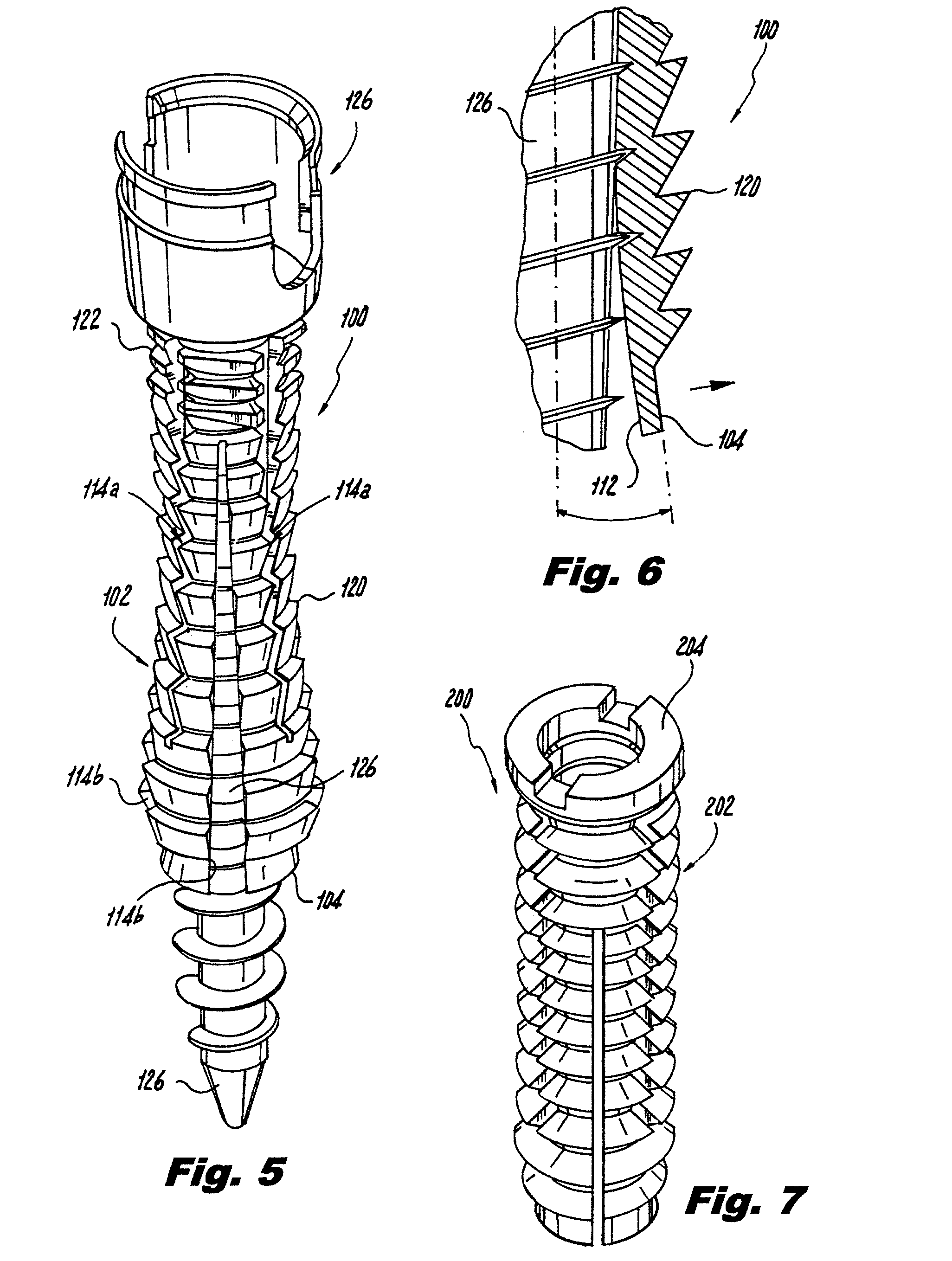 Orthopedic screw insert