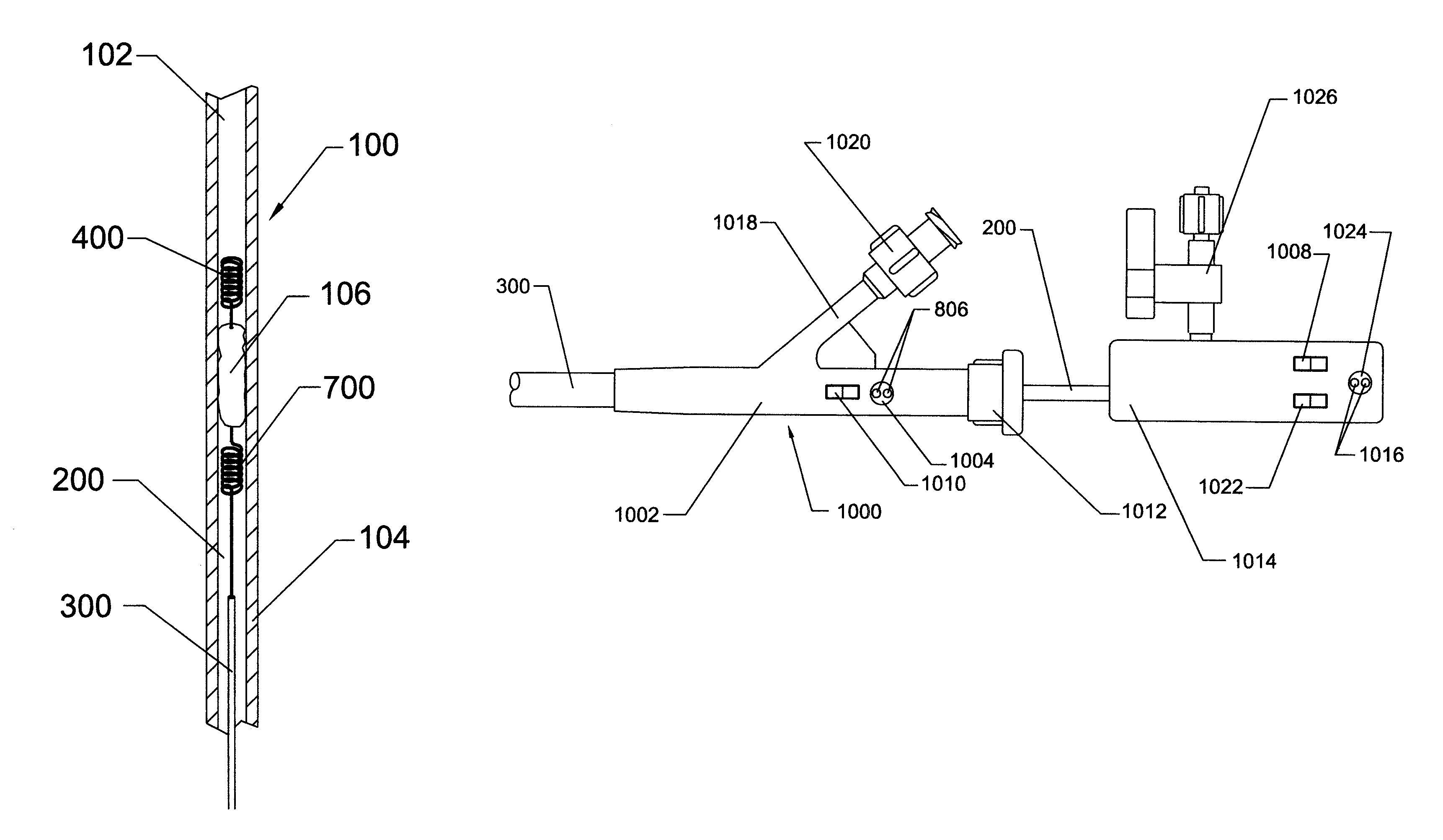 Thrombectomy system and method