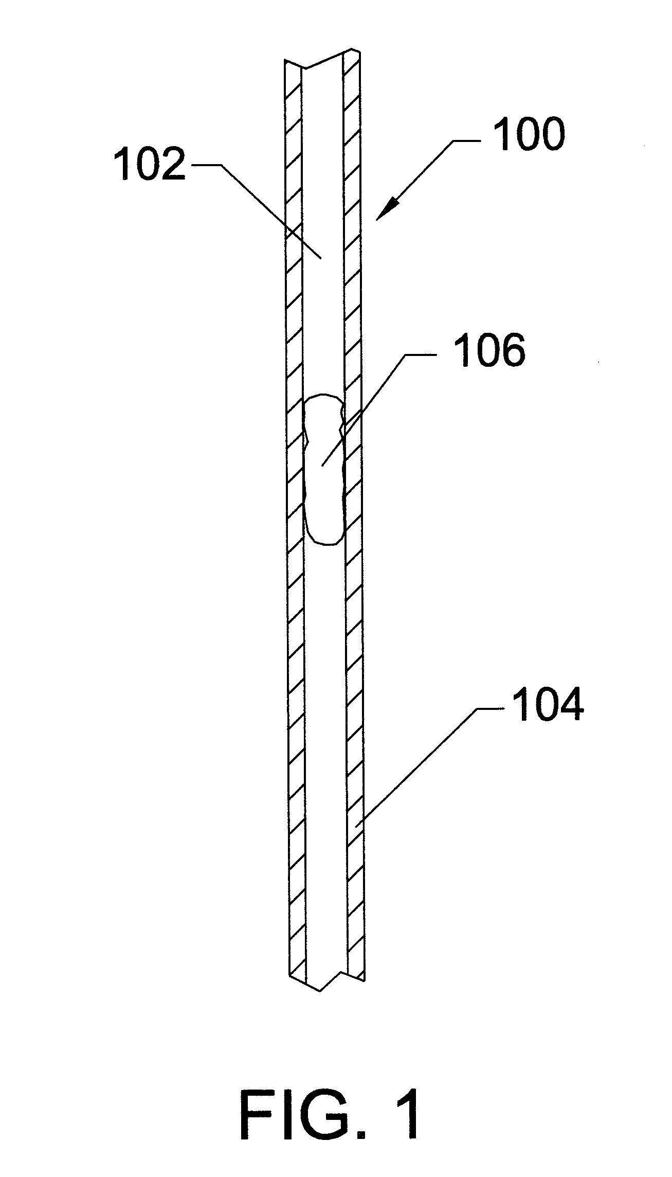 Thrombectomy system and method