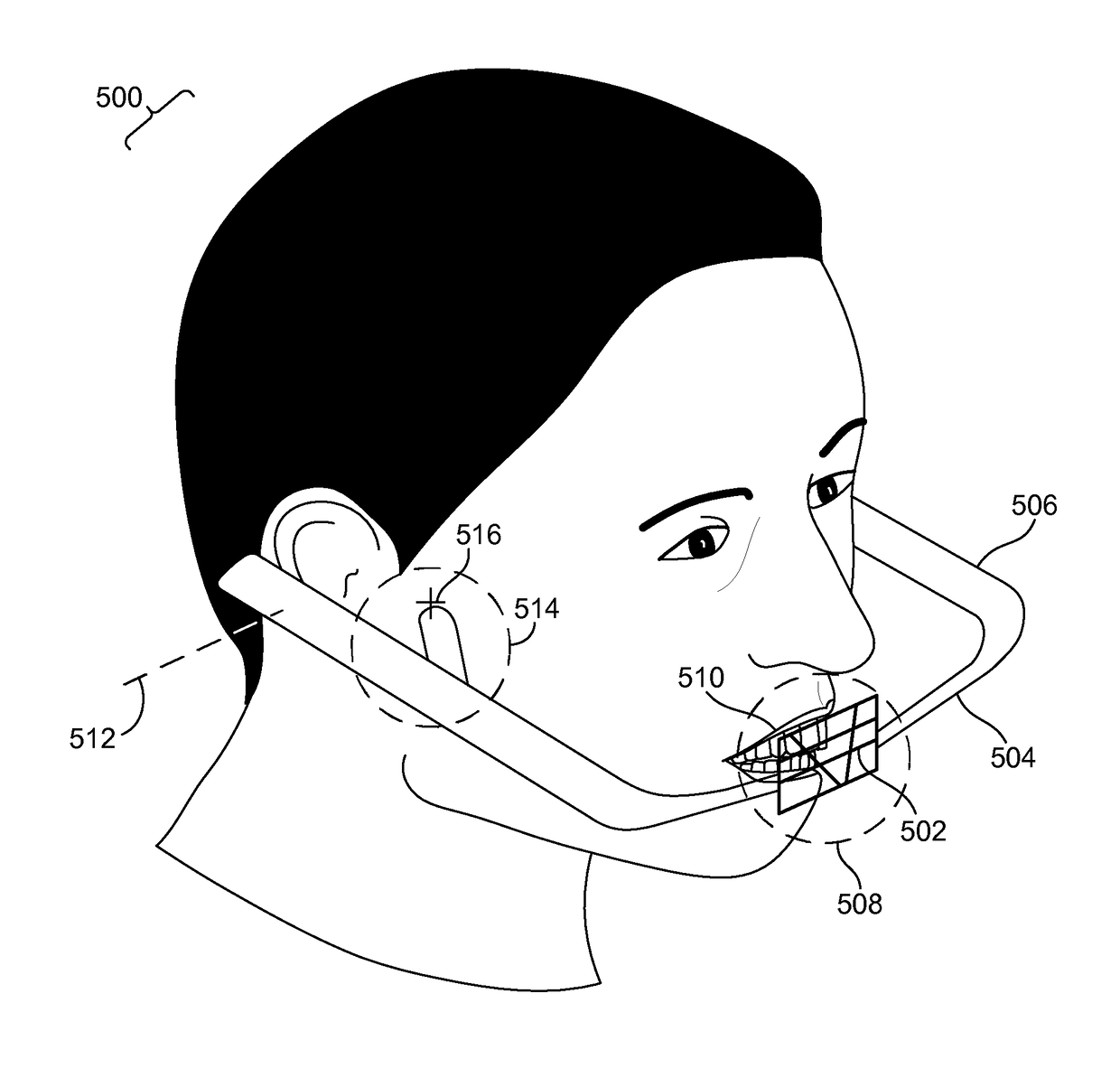 Methods and systems for dental procedures