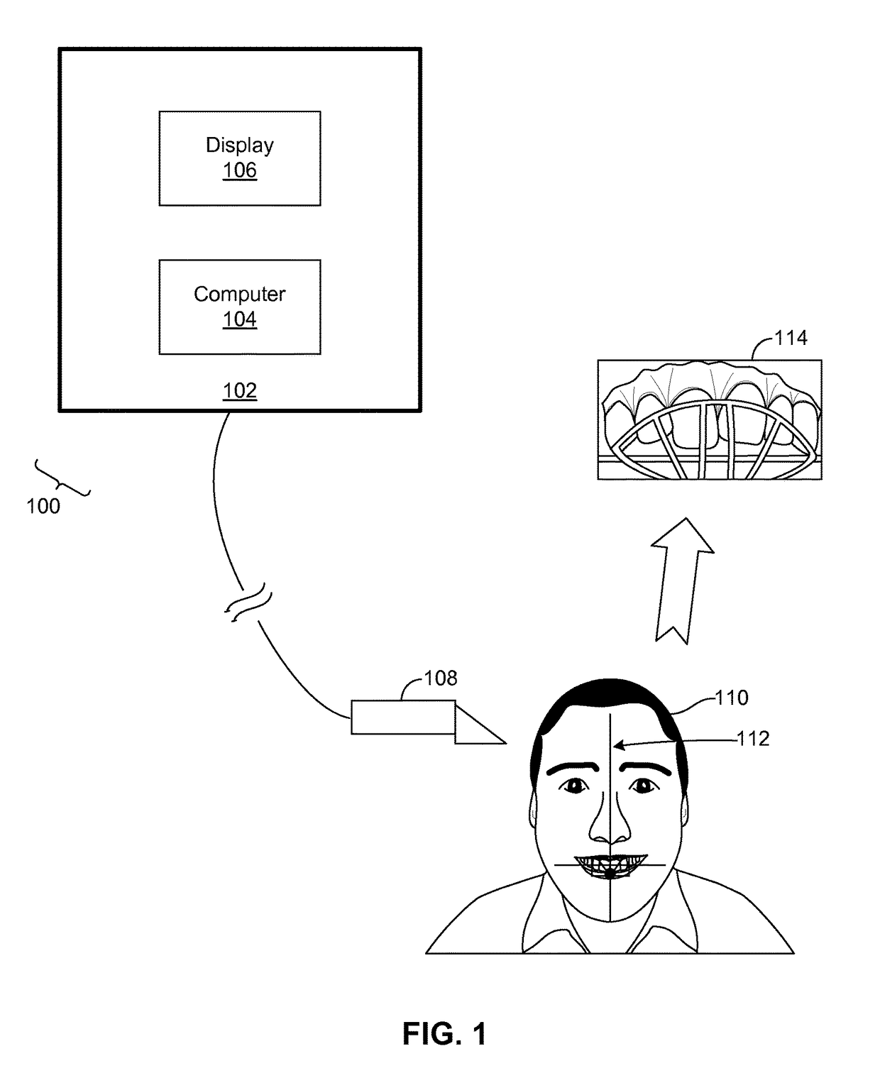 Methods and systems for dental procedures