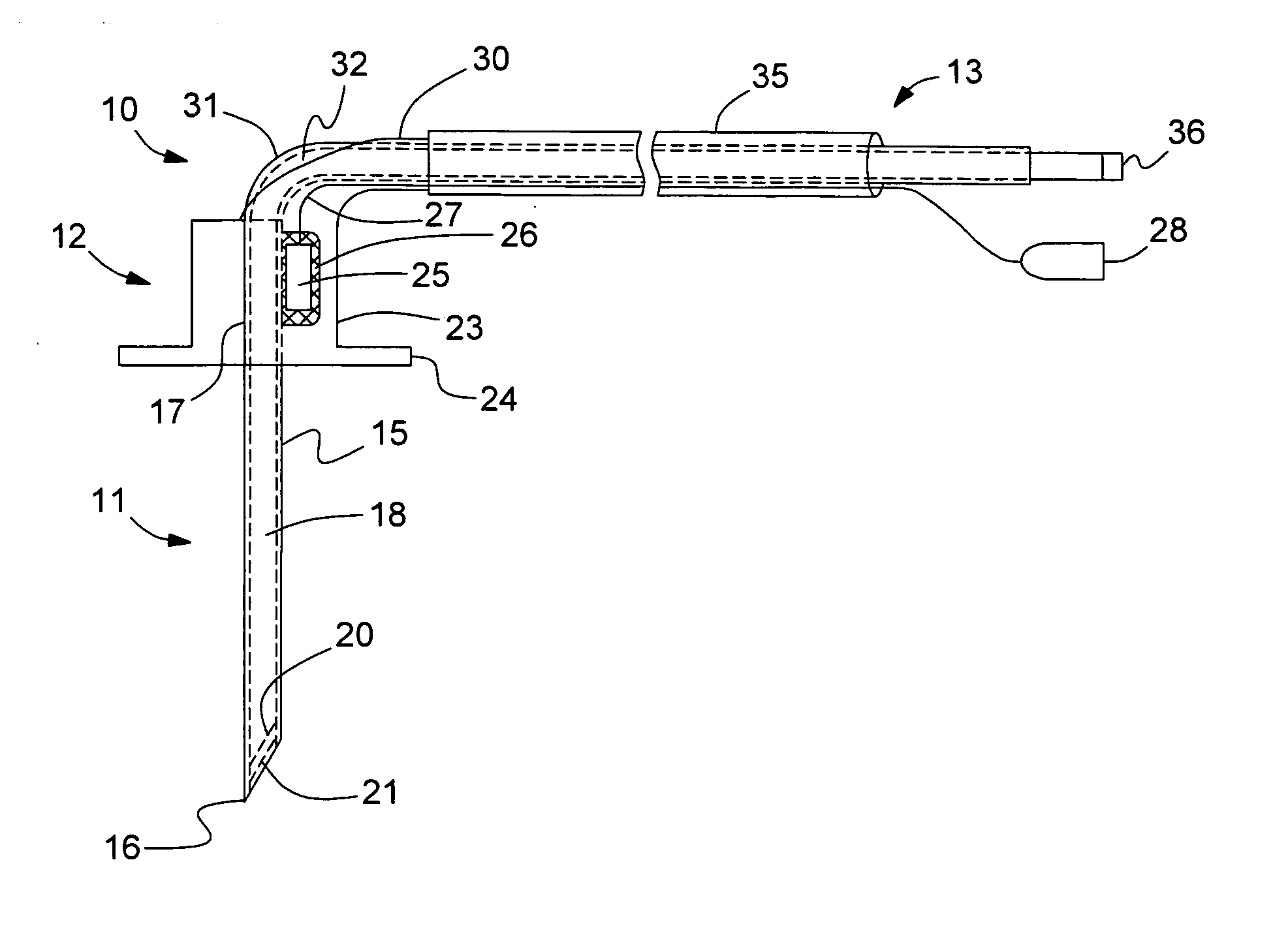 Microsensor needle for pH measurement in tissue