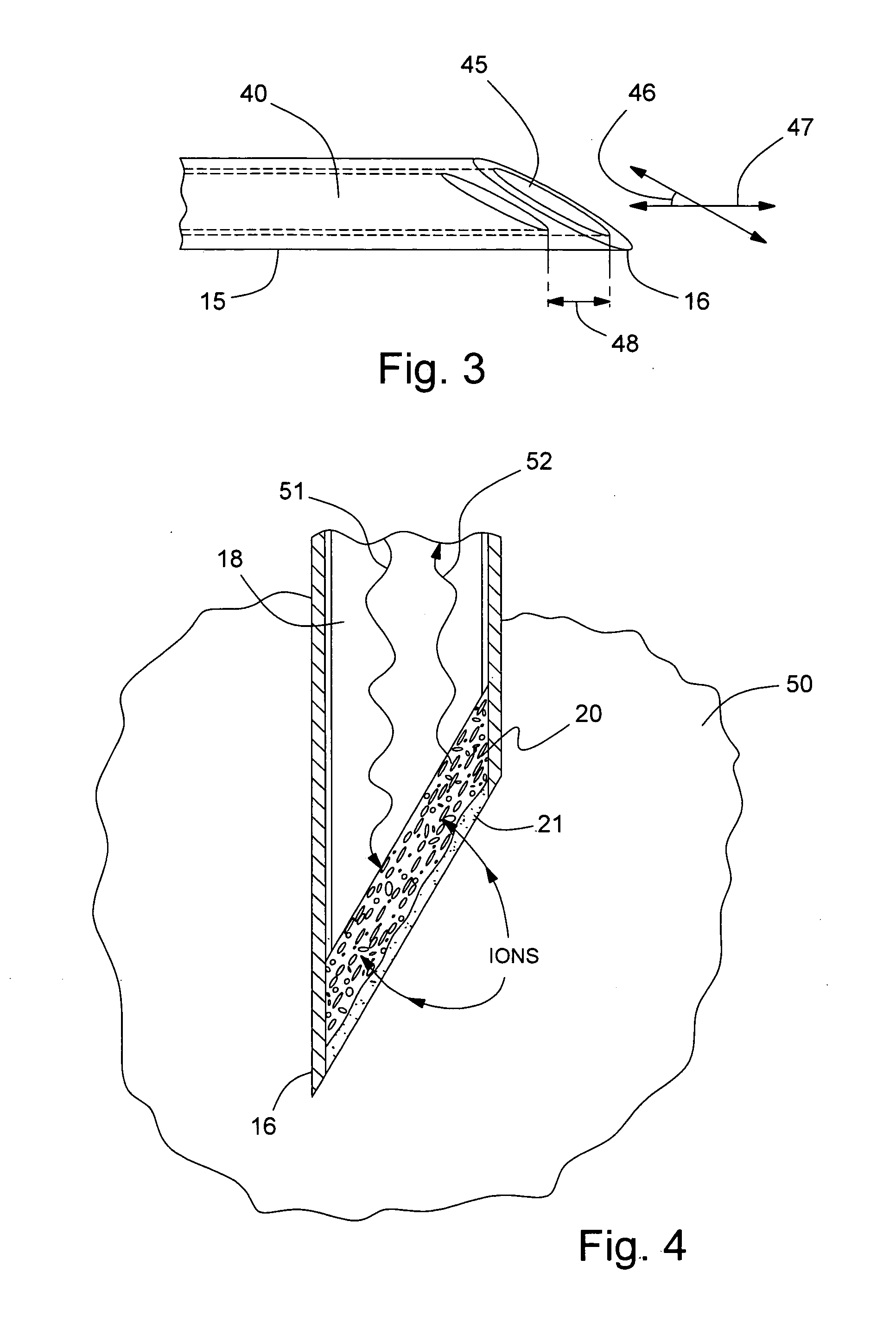 Microsensor needle for pH measurement in tissue