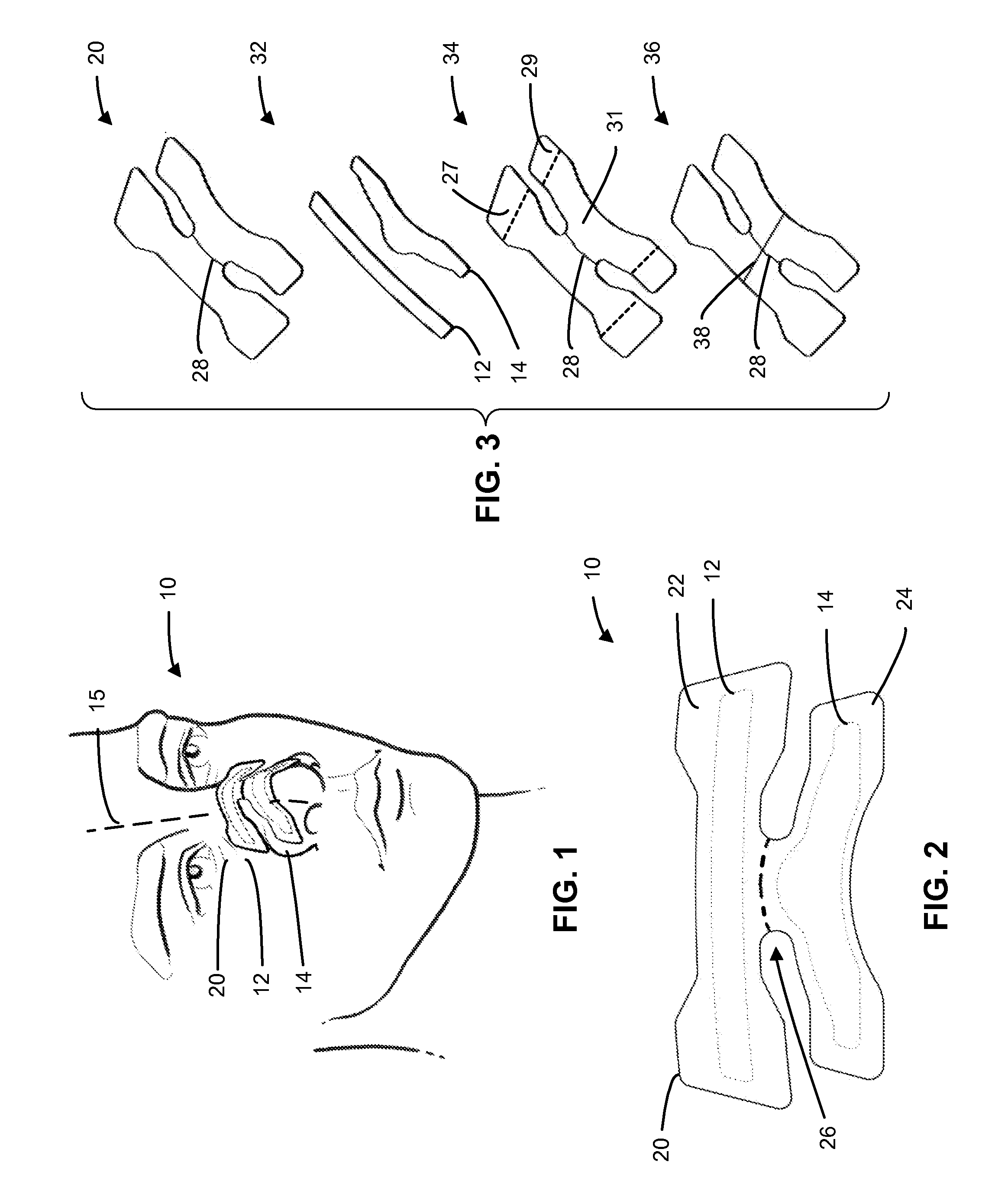 Nasal dilator