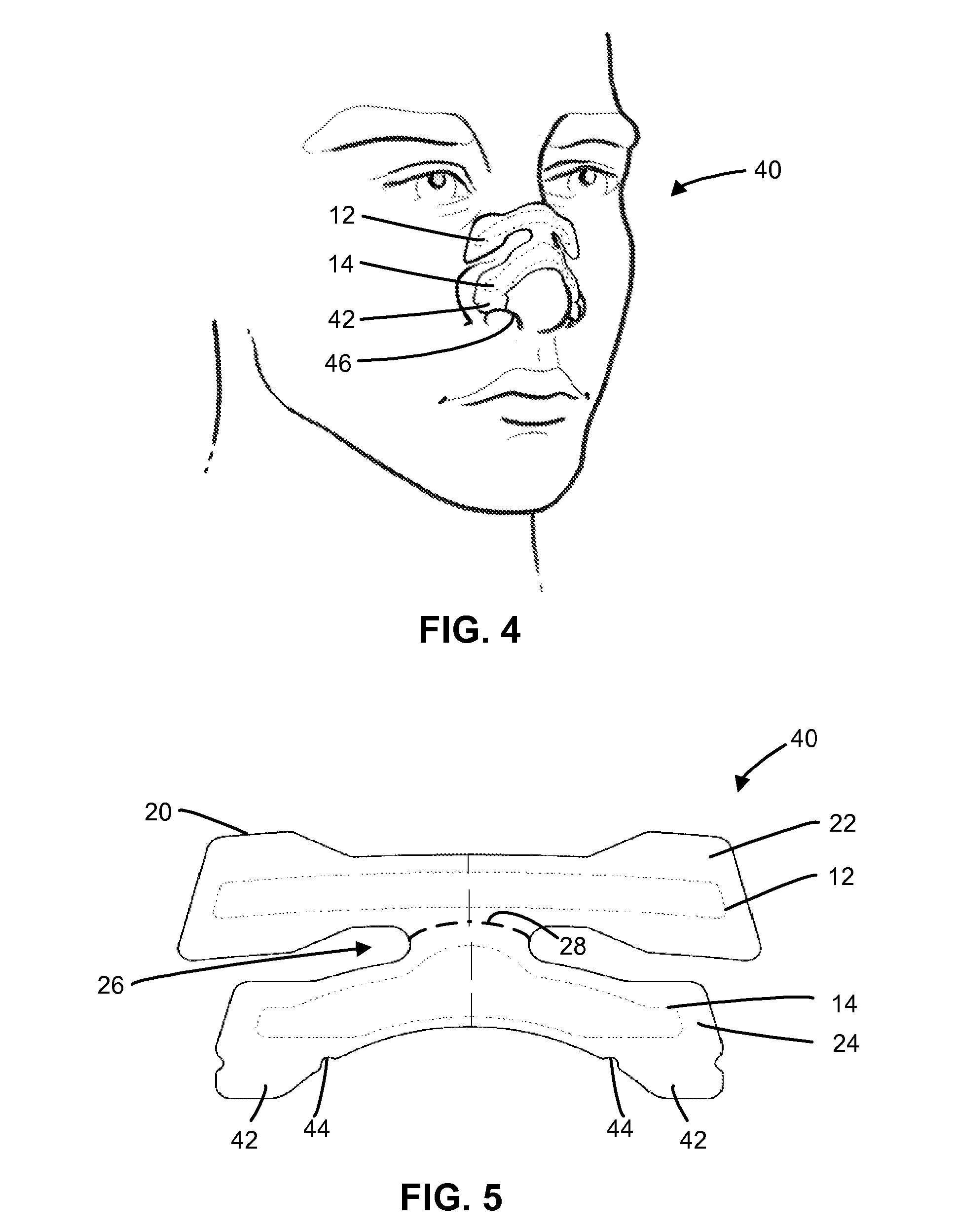 Nasal dilator