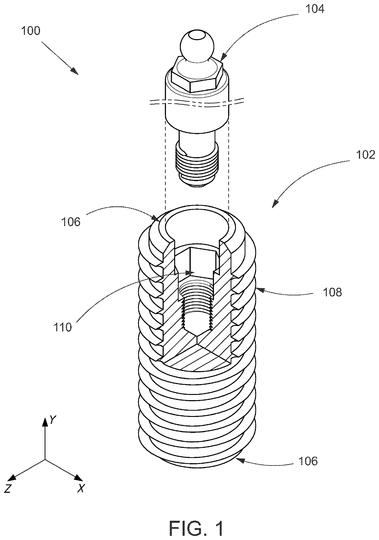 Endosteal horizontally placed dental implant system and method