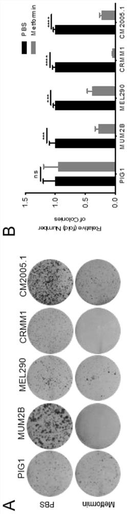 Application of metformin in preparation of medicine for treating eye melanoma