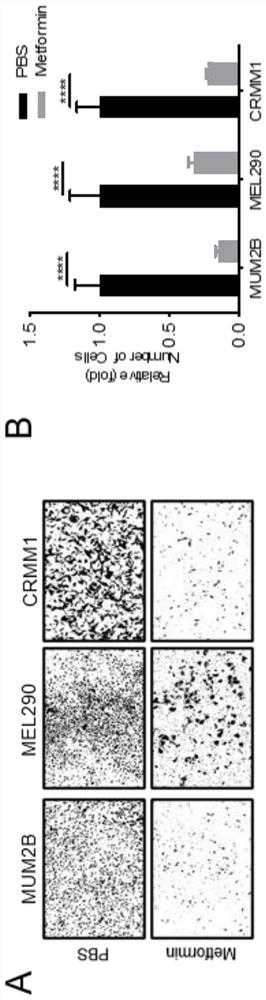 Application of metformin in preparation of medicine for treating eye melanoma