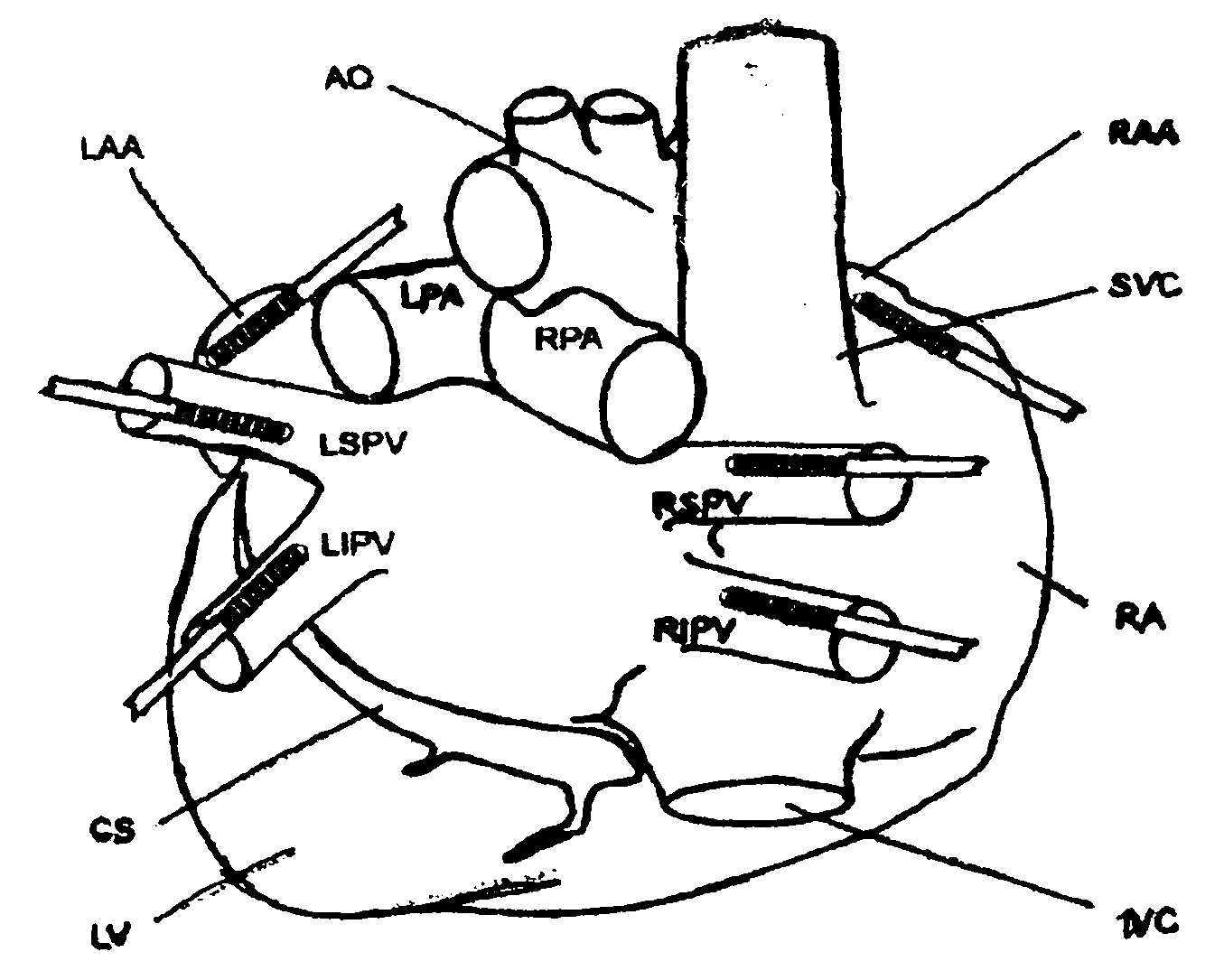 Method for establishing dog vagal trunk nerve stimulation-induced AF (atrial fibrillation) experimental model