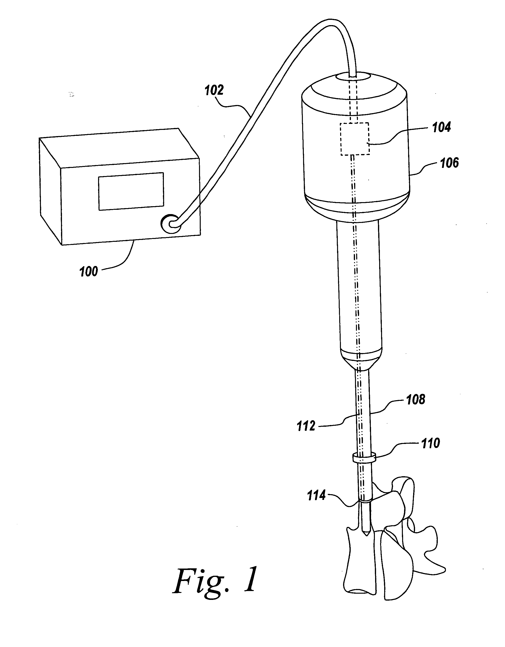 Ultrasonic cutting device