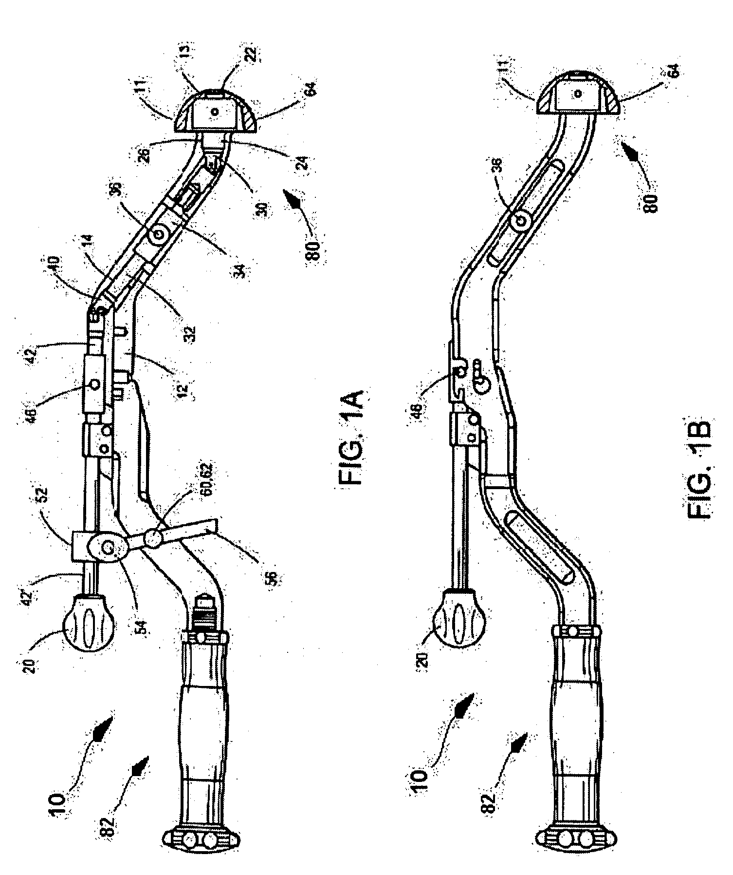 Inserter for minimally invasive joint surgery having interchangeable thread