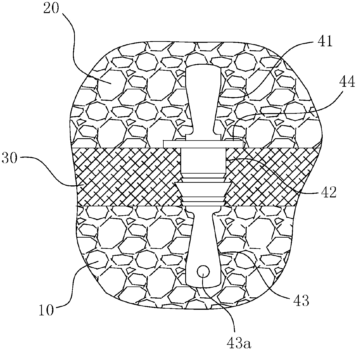 Prefabricated wall plate with heat preservation interlayer and manufacturing method thereof