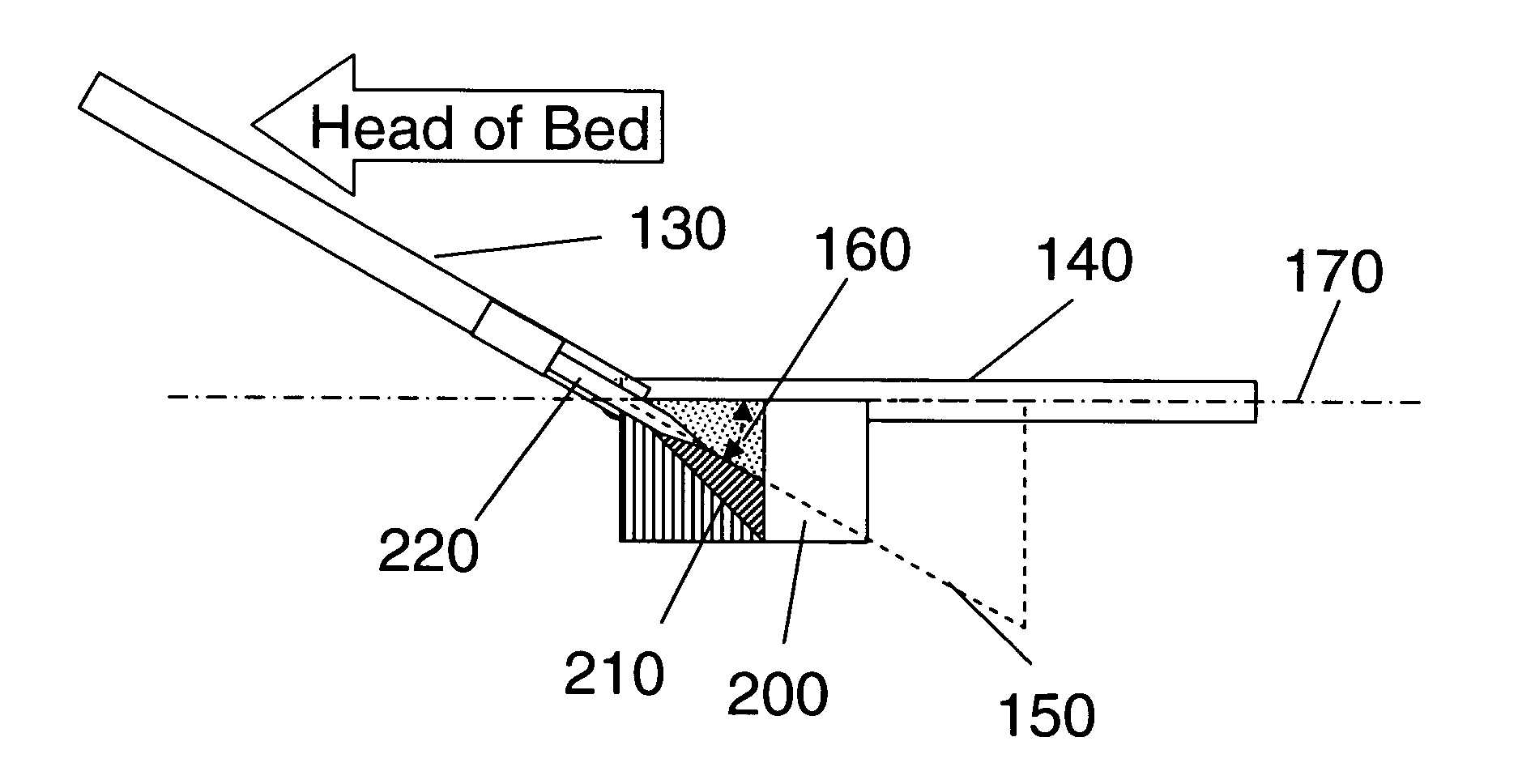 Device to reduce the incidence of aspiration