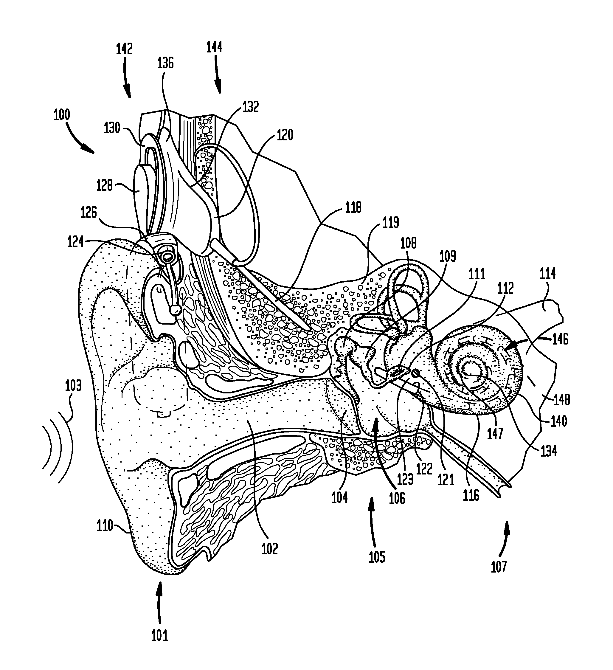 Multi-electrode channel configurations