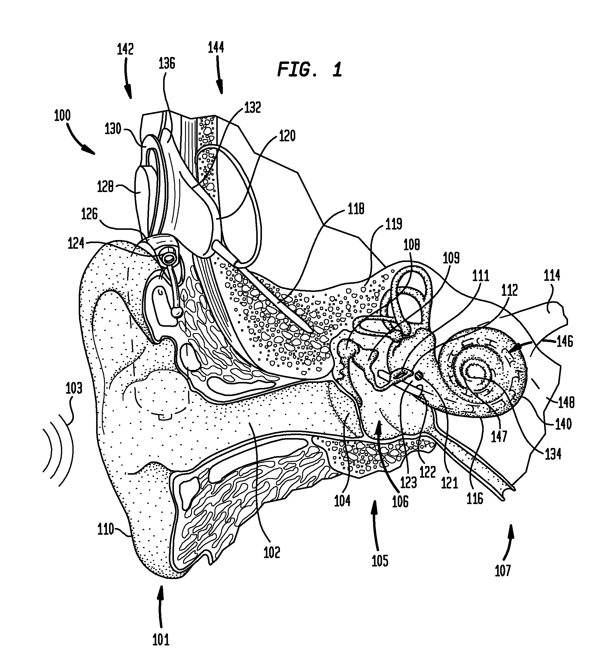 Multi-electrode channel configurations